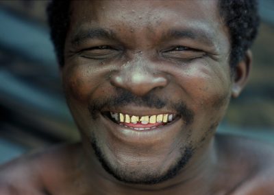 Un chercheur d'or souriant, montre ses belles dents partiellement recouvertes d'or